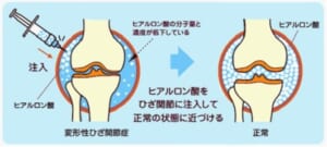 保険治療と再生医療の違いは？